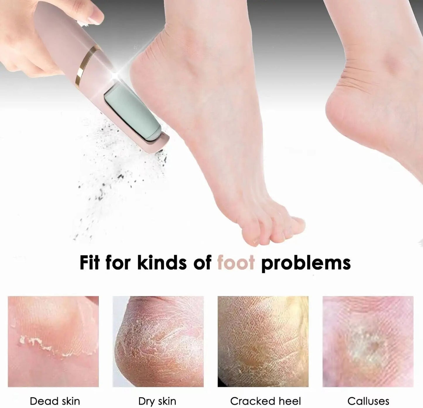 SmoothSole: Your Ultimate Foot Callus Remover and Pedicure Machine